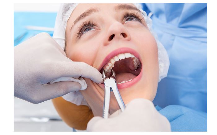 Extraction/Tooth Removal