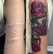 Cover up or tattoo removal and scars coverup 